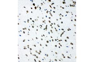 Anti-SHC antibody, IHC(F) IHC(F): Rat Brain Tissue (SHC1 抗体  (C-Term))