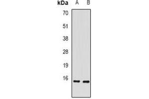 Western blot analysis of RBP2 expression in mouse intestine (A), rat liver (B) whole cell lysates.