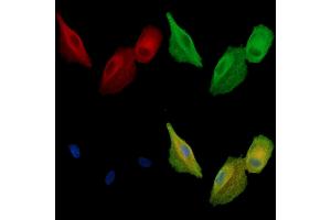 ABIN7095037 and ABIN7099093 staining  cells by IF/ICC. (CCDC39 抗体)