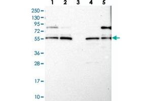 Western blot analysis of Lane 1: RT-4, Lane 2: U-251 MG, Lane 3: Human Plasma, Lane 4: Liver, Lane 5: Tonsil with LRCH4 polyclonal antibody . (LRCH4 抗体)