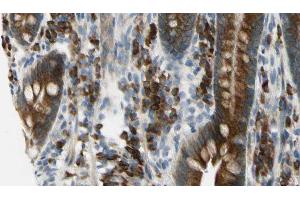 ABIN6275968 at 1/100 staining Mouse intestine tissue by IHC-P. (Adenosine A2a Receptor 抗体  (Internal Region))