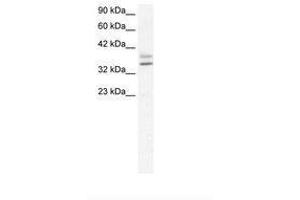 Image no. 1 for anti-Ets Homologous Factor (EHF) (AA 95-144) antibody (ABIN202193) (EHF 抗体  (AA 95-144))
