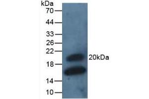 Detection of GREM1 in Rat Intestine Tissue using Polyclonal Antibody to Gremlin 1 (GREM1) (GREM1 抗体  (AA 26-184))
