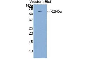Western Blotting (WB) image for anti-Angiotensin I Converting Enzyme (Peptidyl-Dipeptidase A) 1 (ACE) (AA 814-1071) antibody (ABIN1857858) (Angiotensin I Converting Enzyme 1 抗体  (AA 814-1071))