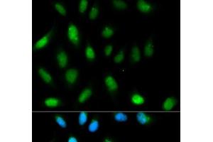 Immunofluorescence analysis of HeLa cells using CBX5 Polyclonal Antibody (CBX5 抗体)