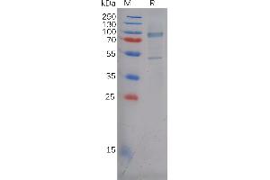 Human Protein, His Tag on SDS-PAGE under reducing condition.
