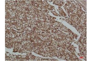 Immunohistochemistry (IHC) analysis of paraffin-embedded Human Liver Tissue using Smad3 Mouse Monoclonal Antibody diluted at 1:200. (SMAD3 抗体)
