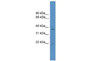 WB Suggested Anti-RHOXF1 Antibody Titration:  0. (RHOXF1 抗体  (N-Term))
