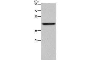 Western Blot analysis of Mouse liver tissue using ENTPD5 Polyclonal Antibody at dilution of 1:500 (ENTPD5 抗体)