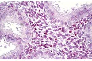 Anti-HMGB1 antibody IHC staining of human, uterus. (HMGB1 抗体  (AA 131-180))