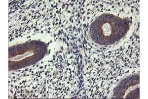 Immunohistochemical staining of paraffin-embedded Human endometrium tissue using anti-ALG2 mouse monoclonal antibody. (ALG2 抗体)