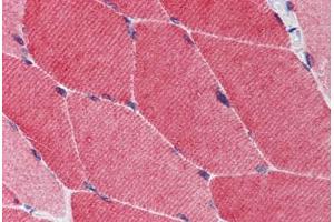 Human Skeletal Muscle: Formalin-Fixed, Paraffin-Embedded (FFPE) (TRIM5 抗体)