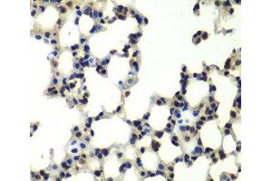 Immunohistochemistry (Paraffin-embedded Sections) (IHC (p)) image for anti-Proteasome (Prosome, Macropain) 26S Subunit, Non-ATPase, 13 (PSMD13) antibody (ABIN7011467)