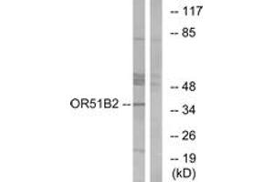 Western blot analysis of extracts from HT-29 cells, using OR51B2 Antibody. (OR51B2 抗体  (AA 196-245))
