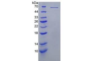 SDS-PAGE analysis of Mouse Perforin 1 Protein. (Perforin 1 蛋白)