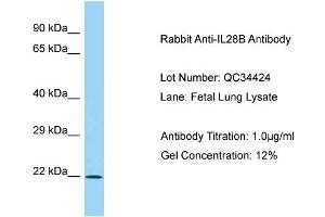 Host: Rabbit Target Name: IL28B Sample Type: Fetal Lung Antibody Dilution: 1. (IL28B 抗体  (C-Term))