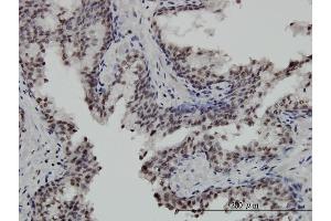 Immunoperoxidase of monoclonal antibody to STK32C on formalin-fixed paraffin-embedded human prostate. (STK32C 抗体  (AA 1-369))