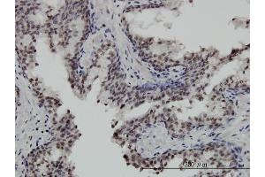 Immunoperoxidase of monoclonal antibody to STK32C on formalin-fixed paraffin-embedded human prostate.