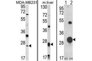 (LEFT) Western blot analysis of GSTM1 Antibody (C-term) in MDA-MB231 cell line lysates (35 µg/lane). (GSTM1 抗体  (C-Term))