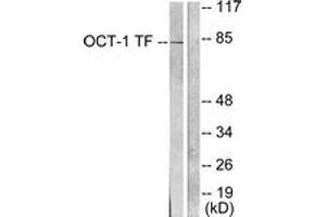 Western blot analysis of extracts from HeLa cells, using OCT1 Antibody. (POU2F1 抗体  (AA 41-90))
