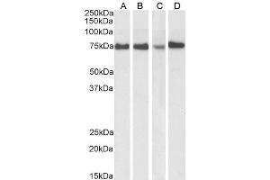 ABIN1590087 (1µg/ml) staining of HeLa (A) and MCF7 (B) cell lysate, and HeLa (C) and Jurkat (D) nuclear cell lysate(35µg protein in RIPA buffer). (ATF6 抗体  (AA 437-449))