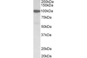 Western Blotting (WB) image for anti-Gelsolin (GSN) (AA 40-51) antibody (ABIN1101907)