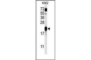 Western blot analysis of GAGE7 Antibody (C-term) in K562 cell line lysates (35ug/lane). (G Antigen 7 抗体  (C-Term))