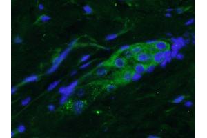 Paraformaldehyde-fixed, paraffin embedded mouse skin, Antigen retrieval by boiling in sodium citrate buffer (pH6) for 15min, Block endogenous peroxidase by 3% hydrogen peroxide for 30 minutes,  Blocking buffer (normal goat serum) at 37°C for 20min, Antibody incubation with FGF18 Polyclonal Antibody (bs-9762R) at 1:400 overnight at 4°C, followed by conjugated Goat Anti-Rabbit IgG antibody (bs-0295G-FITC) for 90 minutes, and DAPI for nuclei staining. (FGF18 抗体  (AA 95-145))