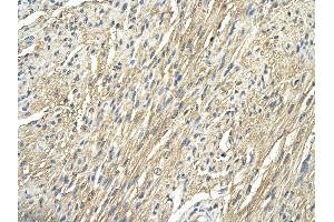 Rabbit Anti-RPS29 antibody        Paraffin Embedded Tissue:  Human Heart   Cellular Data:  cardiac cells  Antibody Concentration:   4. (RPS29 抗体  (N-Term))