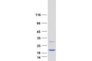 Validation with Western Blot (Peroxiredoxin 5 Protein (PRDX5) (Transcript Variant 2) (Myc-DYKDDDDK Tag))