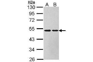 WB Image Sample (30 ug of whole cell lysate) A: Hela B: Hep G2 , 10% SDS PAGE antibody diluted at 1:1000 (ASL 抗体)
