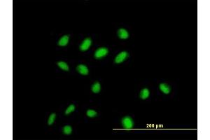 Immunofluorescence of monoclonal antibody to CDYL on HeLa cell. (CDYL 抗体  (AA 153-260))