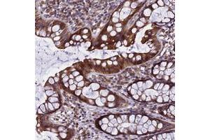 Immunohistochemical staining of human rectum with GIMAP1 polyclonal antibody  shows strong cytoplasmic positivity in glandular cells.