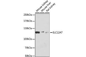 Western Blotting (WB) image for anti-Solute Carrier Family 12 (Potassium-Chloride Transporter) Member 7 (SLC12A7) (AA 1-70) antibody (ABIN6147845)