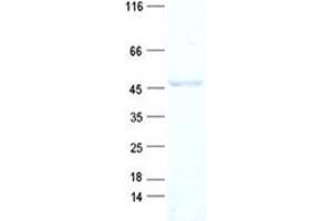 ACOT1 Protein (His tag)
