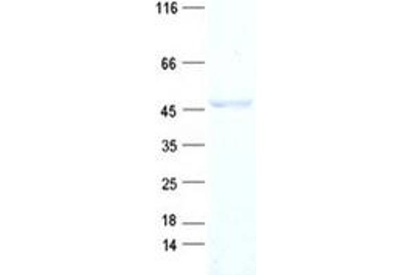 ACOT1 Protein (His tag)