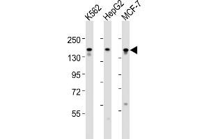 All lanes : Anti-RGEF1 Antibody (Center) at 1:1000-1:2000 dilution Lane 1: K562 whole cell lysates Lane 2: HepG2 whole cell lysates Lane 3: MCF-7 whole cell lysates Lysates/proteins at 20 μg per lane. (GRF2 抗体  (AA 536-569))