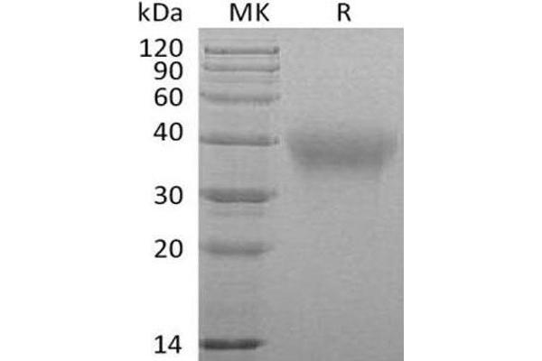 FZD1 Protein (Fc Tag)