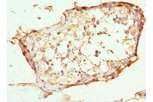 Immunohistochemistry of paraffin-embedded human testis tissue using ABIN7144903 at dilution of 1:100 (ABCC11 抗体  (AA 1-170))