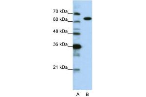 WB Suggested Anti-KARS Antibody Titration:  0. (KARS 抗体  (C-Term))