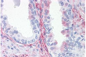 Human Prostate: Formalin-Fixed, Paraffin-Embedded (FFPE) (Aquaporin 8 抗体  (AA 1-255))