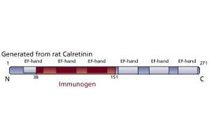 Image no. 3 for anti-Calbindin 2 (CALB2) (AA 38-151) antibody (ABIN968244) (Calretinin 抗体  (AA 38-151))