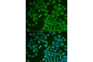 Immunofluorescence analysis of U2OS cells using PNLIP antibody (ABIN6128521, ABIN6145838, ABIN6145840 and ABIN6222025). (PNLIP 抗体  (AA 166-465))