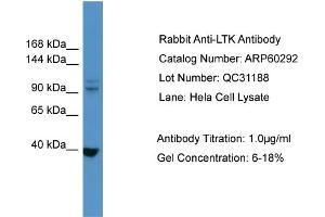WB Suggested Anti-LTK  Antibody Titration: 0. (LTK 抗体  (N-Term))