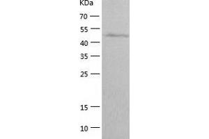 Western Blotting (WB) image for ERO1-Like Protein alpha (ERO1L) (AA 24-468) protein (His tag) (ABIN7122815) (ERO1L Protein (AA 24-468) (His tag))