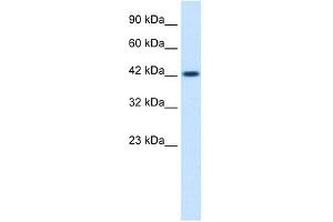 WB Suggested Anti-ZP3 Antibody Titration:  0. (Zona Pellucida Glycoprotein 3 抗体  (C-Term))