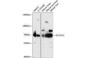 Western Blotting (WB) image for anti-Solute Carrier Family 32 (GABA Vesicular Transporter), Member 1 (SLC32A1) (AA 1-120) antibody (ABIN6147981)