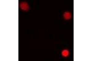 Immunofluorescent analysis of HMG-20A staining in MCF7 cells. (HMG20A 抗体)