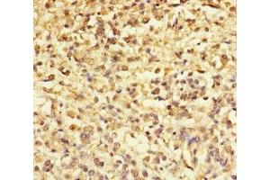 Immunohistochemistry (IHC) image for anti-Transmembrane Protein with EGF-Like and Two Follistatin-Like Domains 2 (TMEFF2) (AA 41-320) antibody (ABIN7172299)
