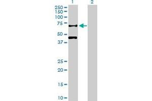 Western Blotting (WB) image for anti-Recombination Signal Binding Protein For Immunoglobulin kappa J Region (RBPJ) (AA 1-487) antibody (ABIN516966)